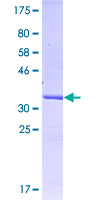 12.5% SDS-PAGE Stained with Coomassie Blue